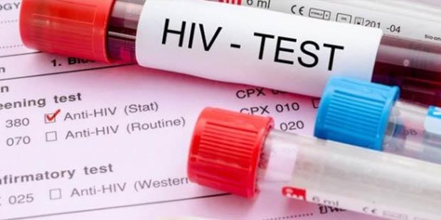 Türkiye’de HIV görülme yaşı 15’e kadar indi