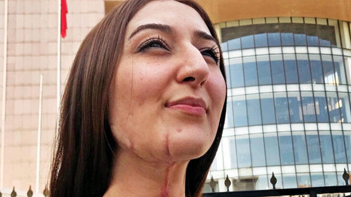 Rabia Kaçmaz'dan kendisine işkence yapan Emre Çiçek'in avukatına: Bir de kadın olacaksın