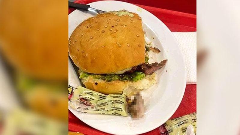 Yediği hamburgerden insan parmağı çıktı!