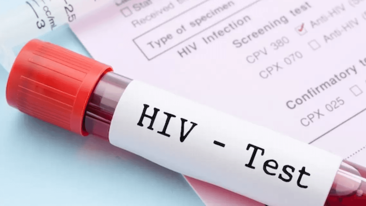 Türkiye'de son üç yılda 10 bin kişiye HIV tanısı konuldu 