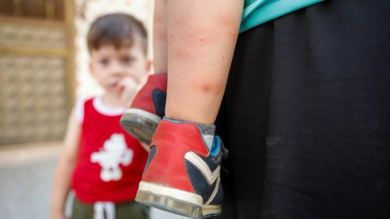 İstanbul'da ''Aedes'' türü sivrisinek tehdidi