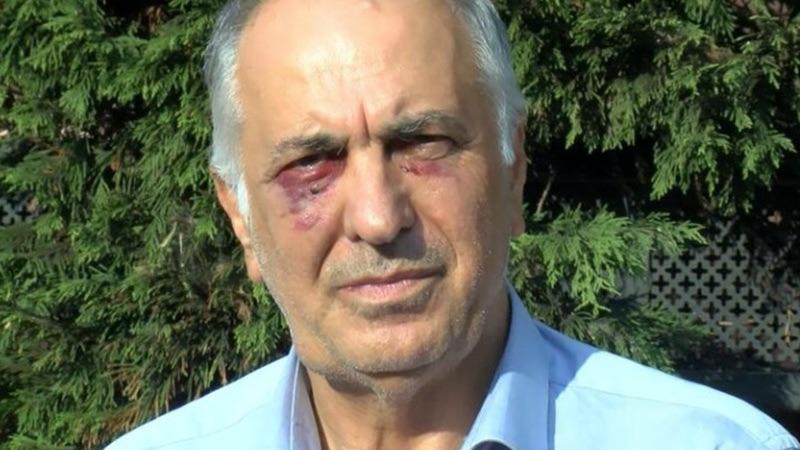 Alevi Vakıfları Federasyonu Başkanı Doğan: Selami Sarıtaş'a yapılan saldırı basit bir yaralama değil; organize bir olaydır