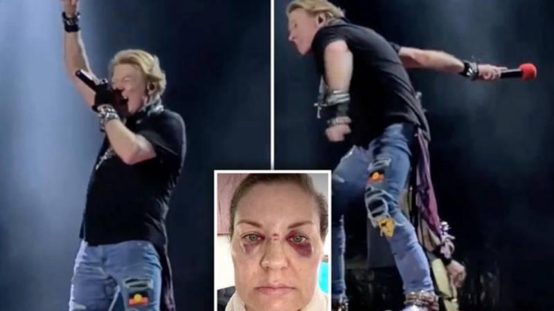 Guns N' Roses solisti Axl Rose'un sahneden fırlattığı mikrofon, seyirciyi yaraladı: "Artık fırlatmayacağım"