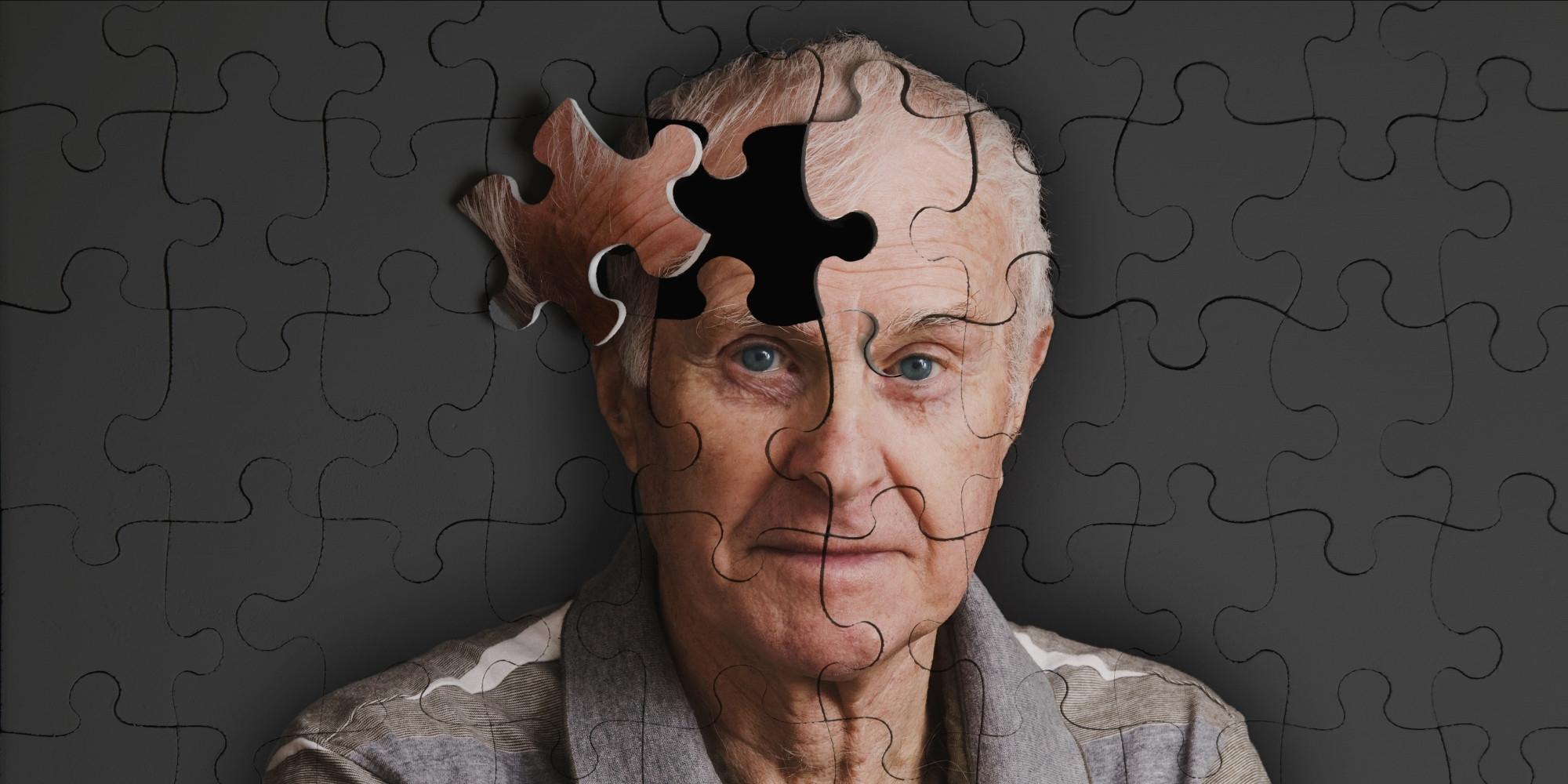 Alzheimer'ın belirtileri neler?